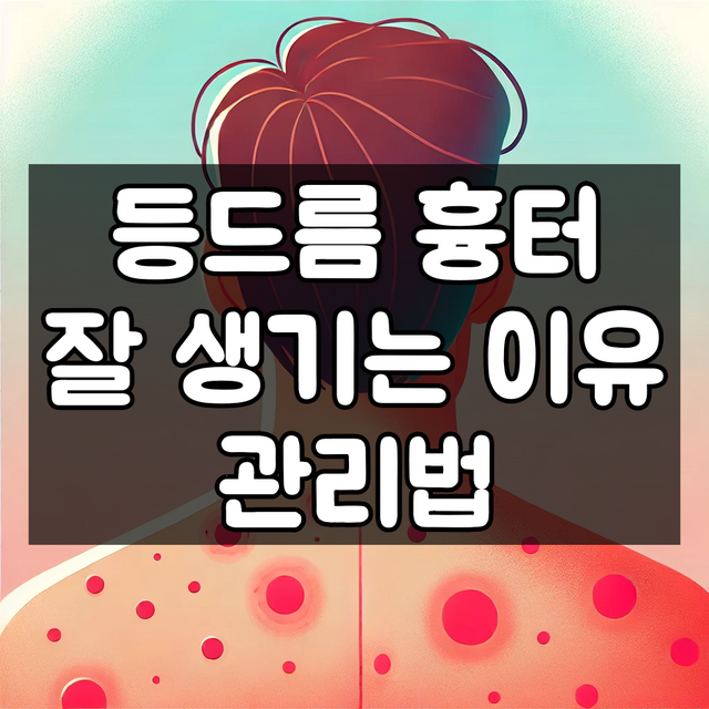 등드름 흉터 잘 생기는 이유와 관리법