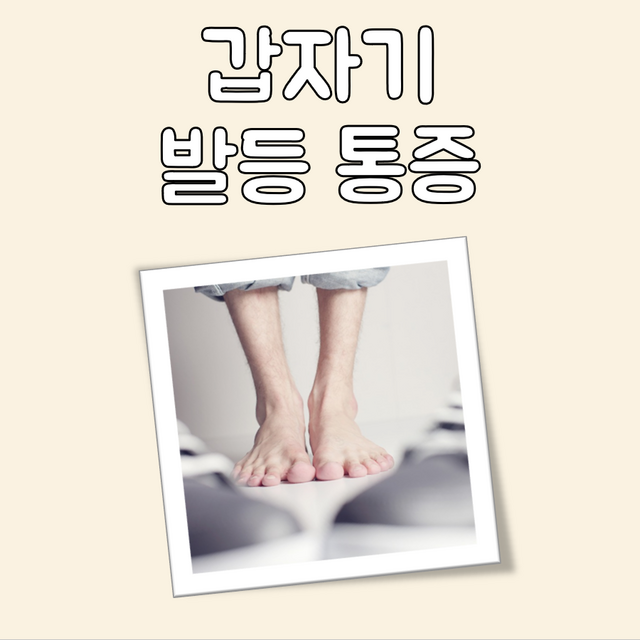 갑자기 발등 통증 대표 이미지