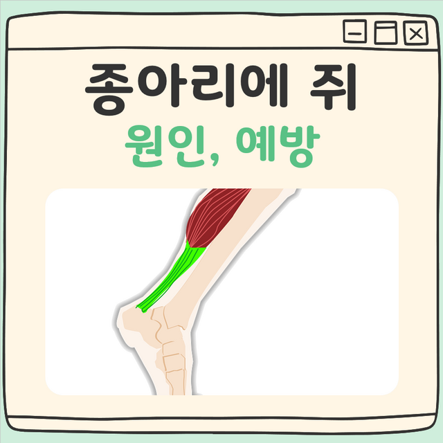 종아리에 쥐가나요? 원인과 예방 방법 간단 정리