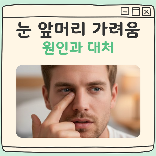 눈 앞머리 간지러움 원인과 대처 대표 이미지