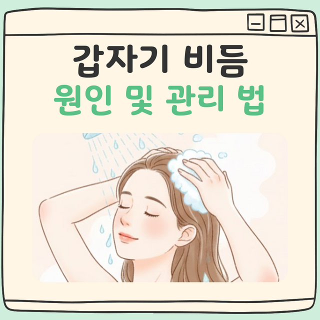 갑자기 비듬 대표 이미지